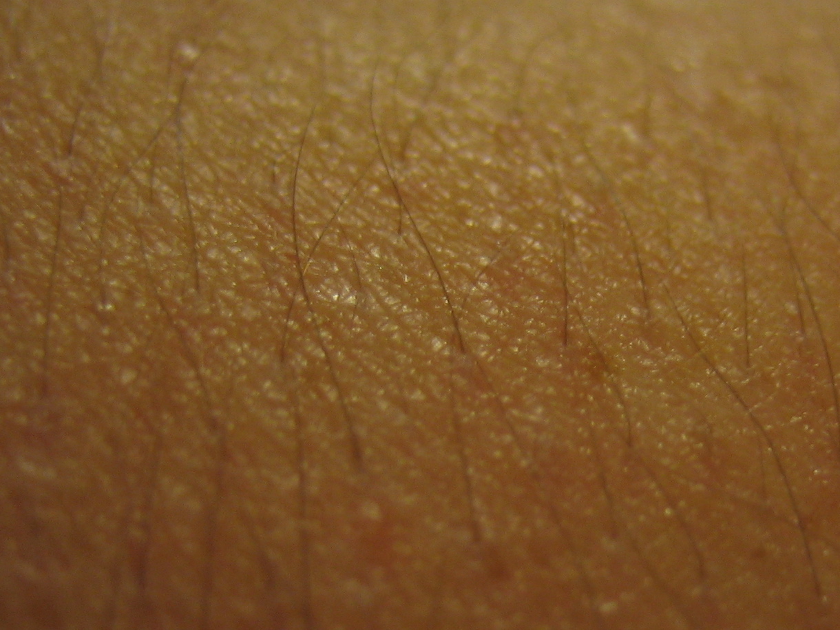 Diseases that Cause Bumps On Skin