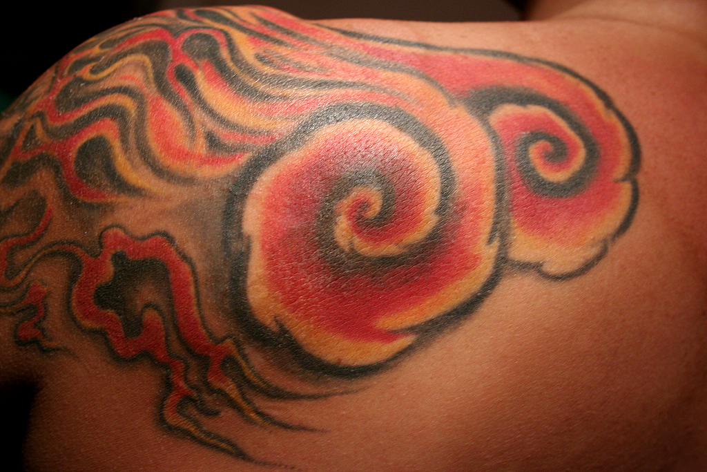 Keratosis Pilaris And Tattoos Keratosis Pilaris And Tattoos